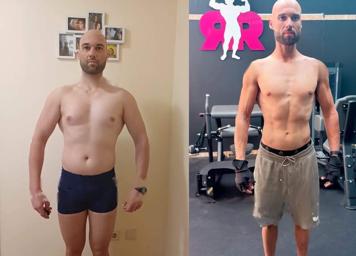 Cliente de frente, antes e 90 dias depois